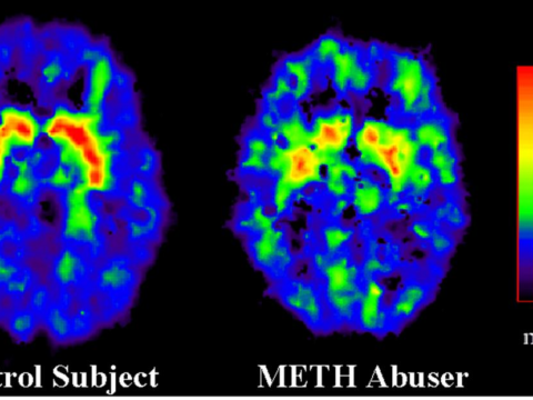 Getting the best remedies against the earliest substance abuse