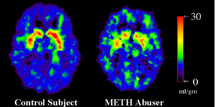 Getting the best remedies against the earliest substance abuse