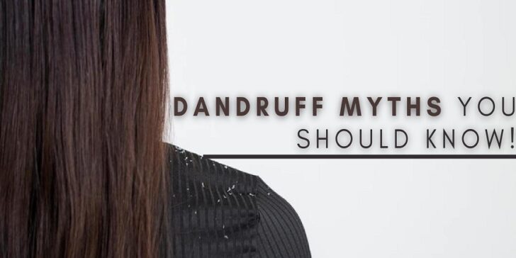 dandruff myth